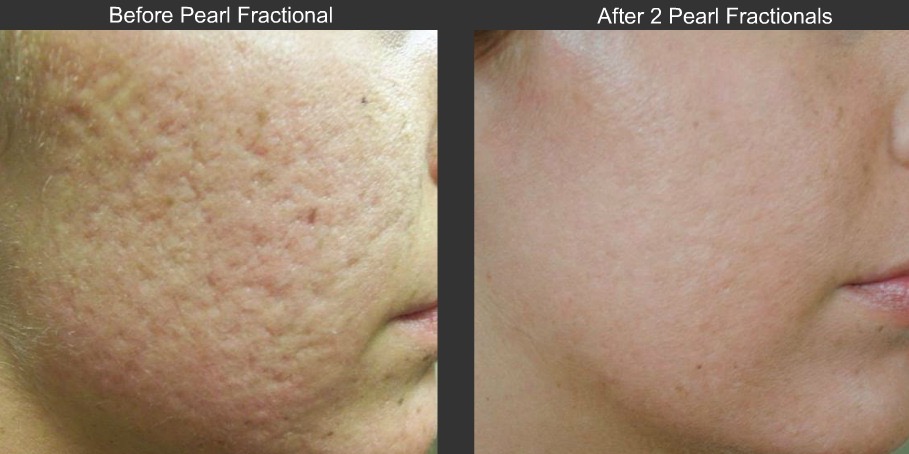Medical spa facial rejuvenation
