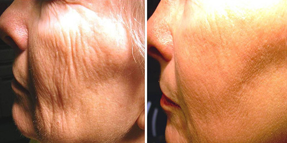 Medical spa skincare treatment