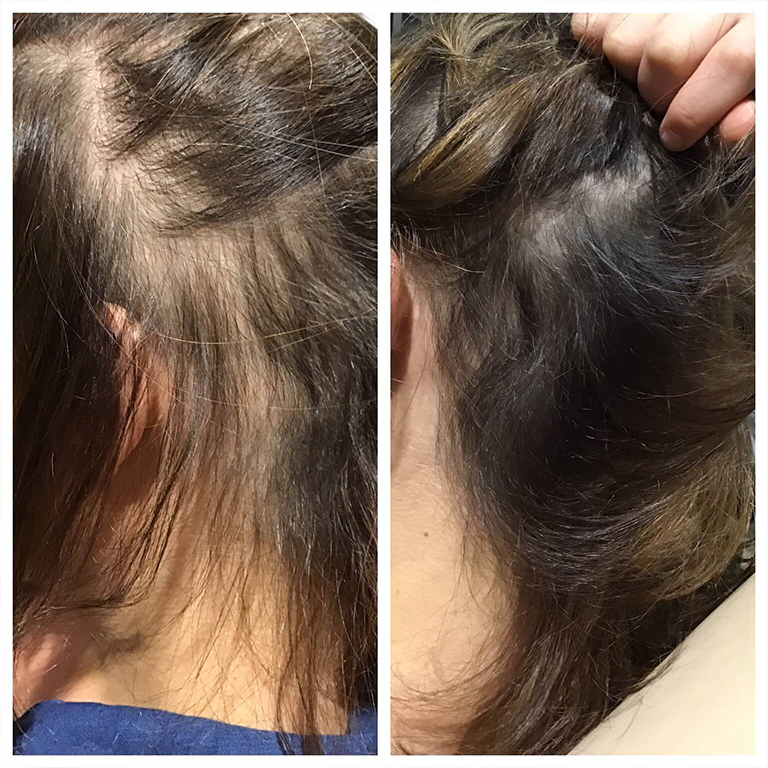 3D Brows Microblading Chicago